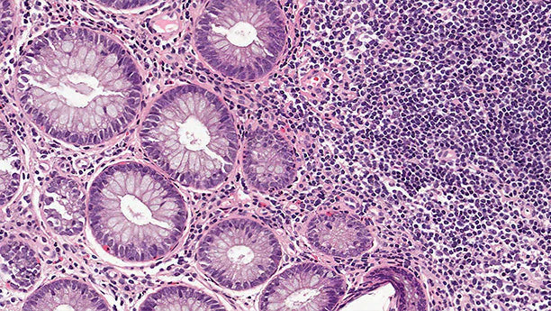 NR Boosts NAD+ Levels